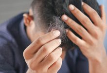 hair-loss-solutions:-causes,-treatments,-and-how-to-take-control