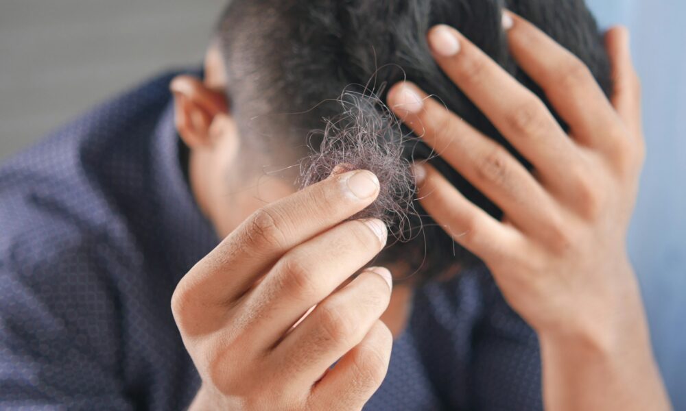 hair-loss-solutions:-causes,-treatments,-and-how-to-take-control