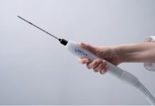 a-gentler-approach:-how-cryoablation-is-changing-the-breast-cancer-conversation